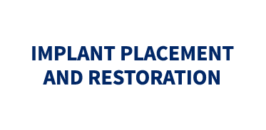 Implant Placement and Restoration